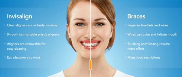  King Orthodontics Invisalign Pittsburgh
