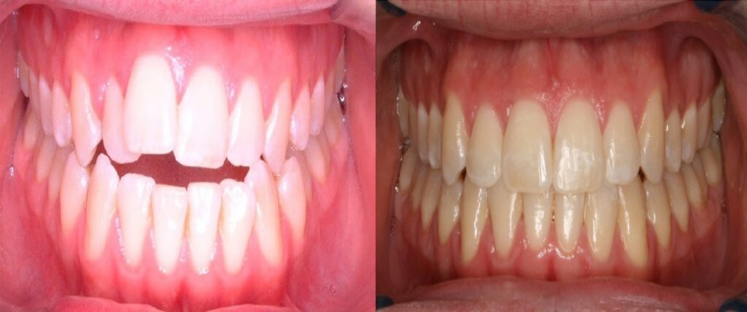 King Orthodontics